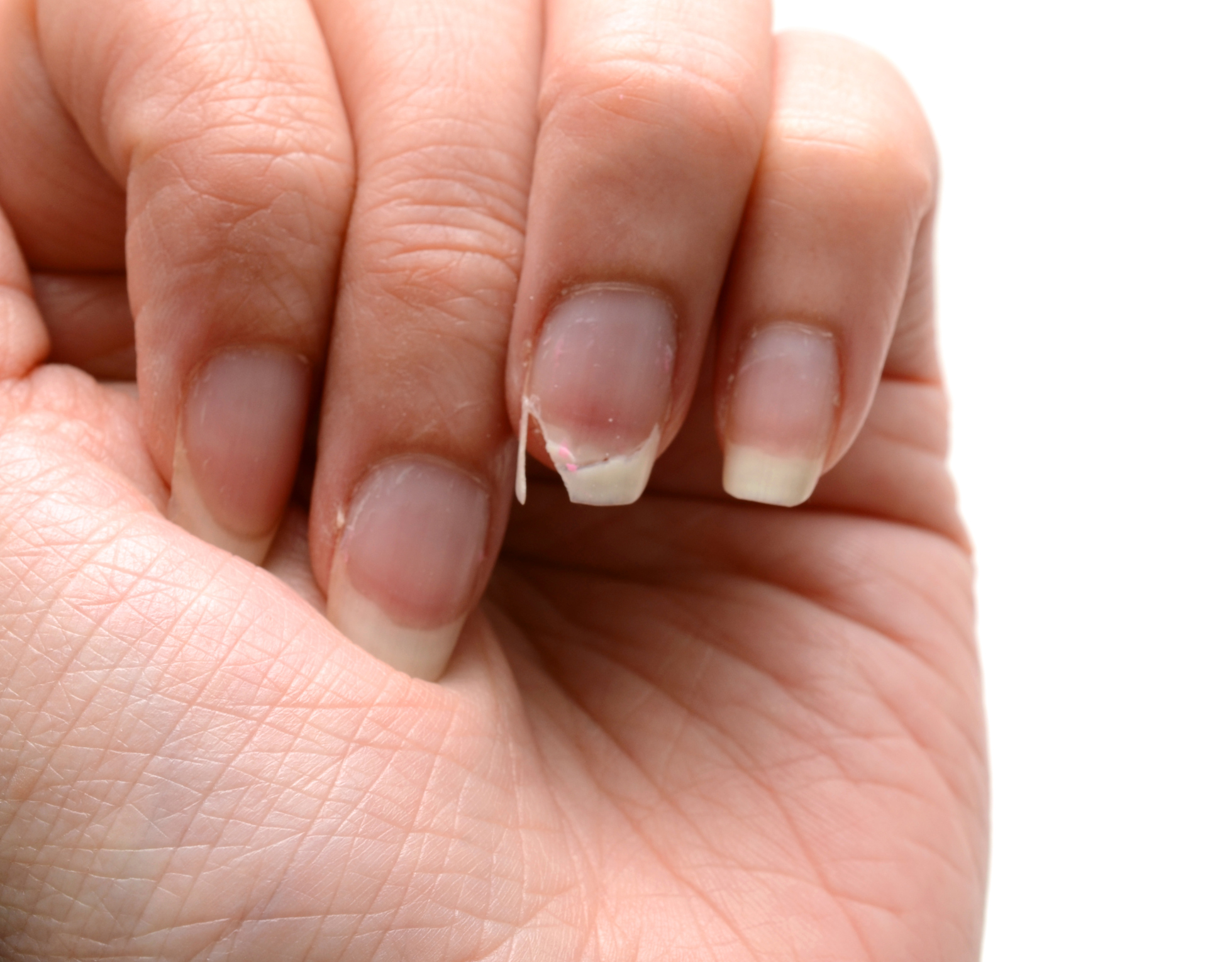 Collagen supplements may boost nail growth and appearance: Human data